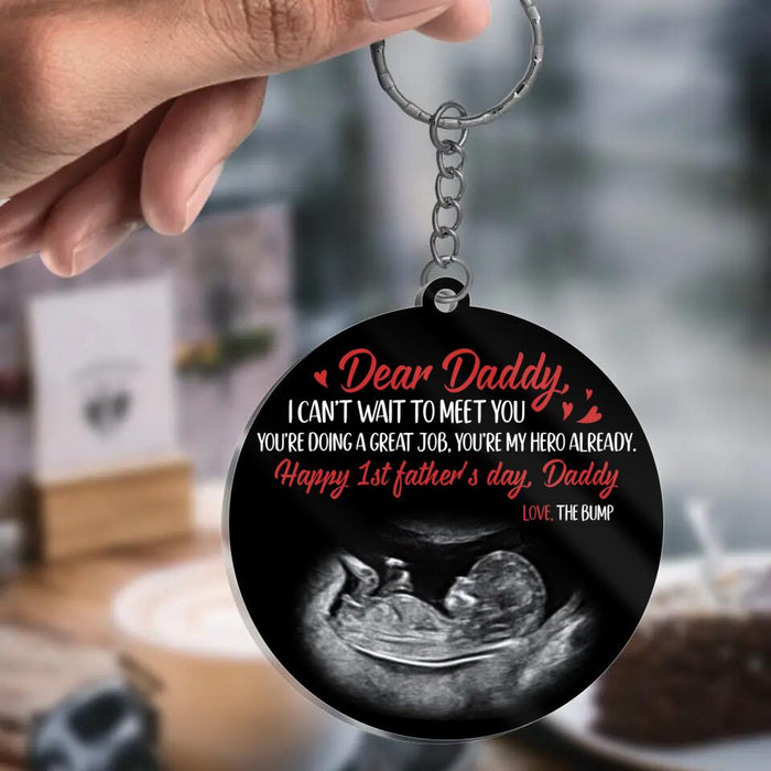 Personalized Father Acrylic Keychain - Upload Photo - Gift Idea for Father's Day - Dear Daddy I Can't Wait To Meet You